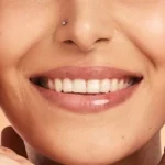 How Your Laugh Lines Quietly Shape a Surgical Plan